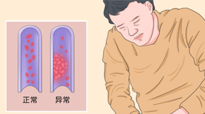 VTE的危害您了解嗎？