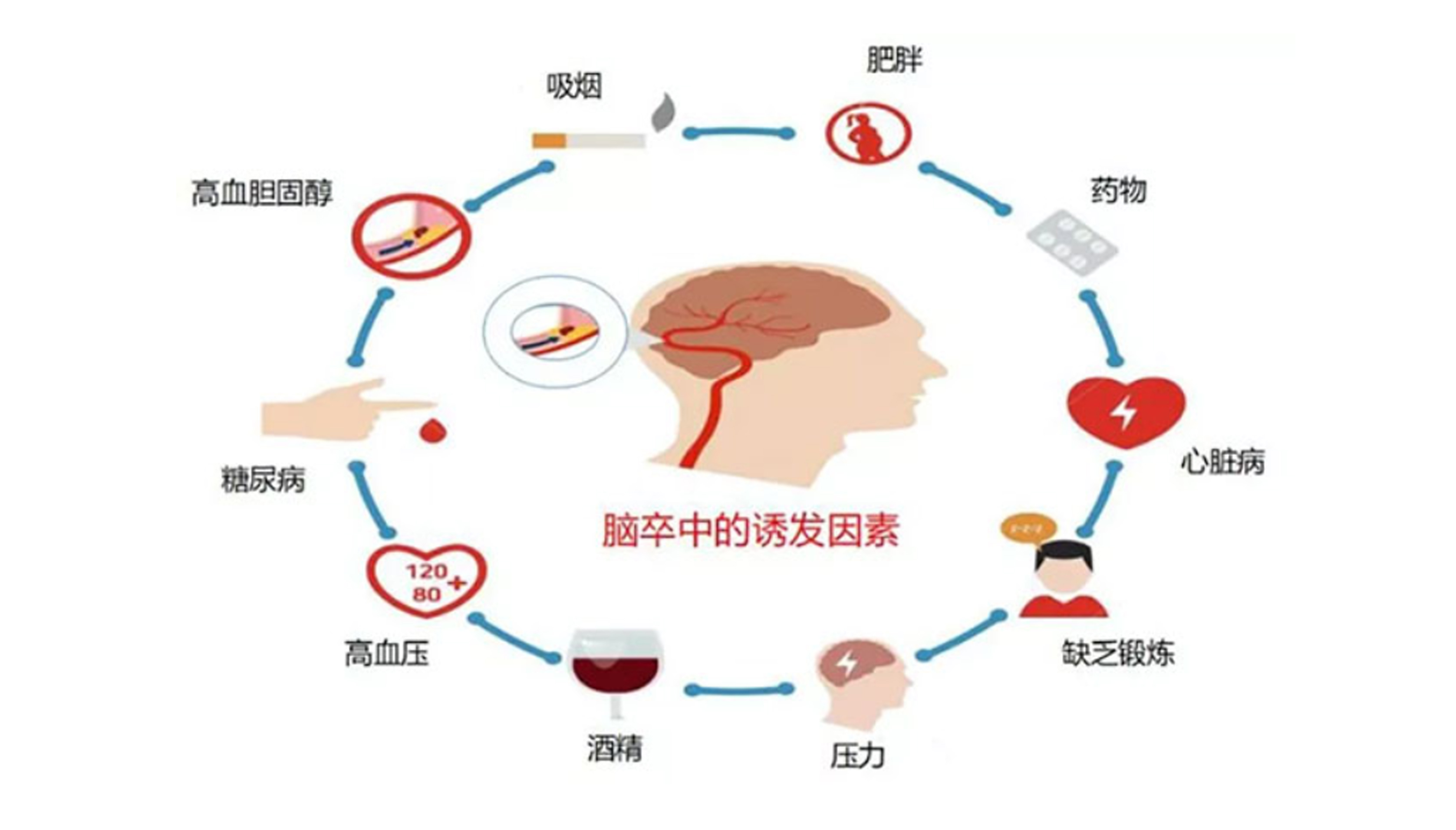 腦梗與深靜脈血栓：不可忽視的血管危機(jī)
