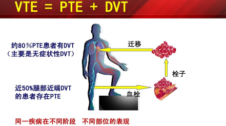 什么是臨床上一致公認(rèn)的VTE防治基礎(chǔ)？