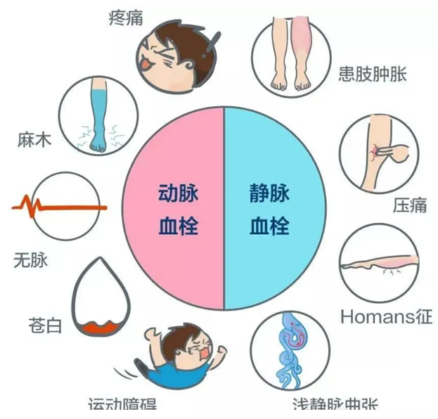 2022世界血栓日：就醫(yī)有新路，血栓找介入