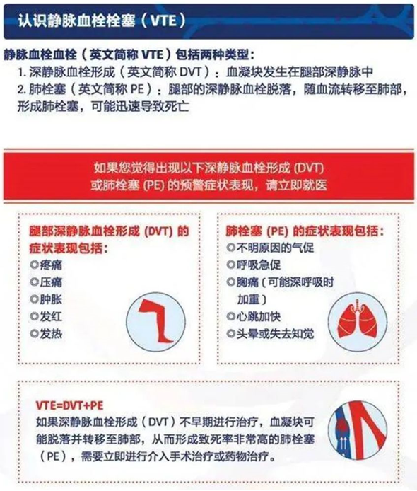 2022世界血栓日：就醫(yī)有新路，血栓找介入