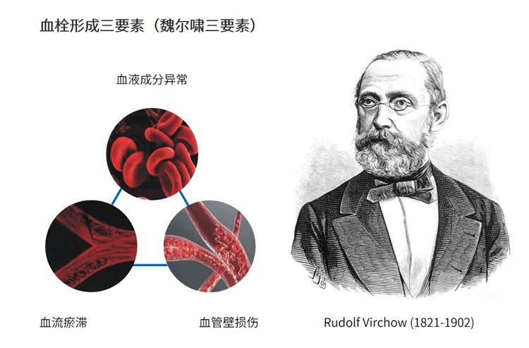 世界血栓日 | 拴不住，動(dòng)起來(lái)
