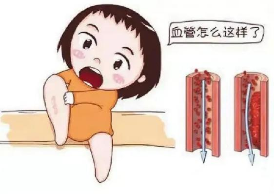 腫瘤不容忽視的第二號殺手—VTE，該如何防治？