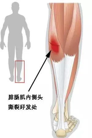 深靜脈血栓類似病癥的認(rèn)識(shí)與區(qū)分