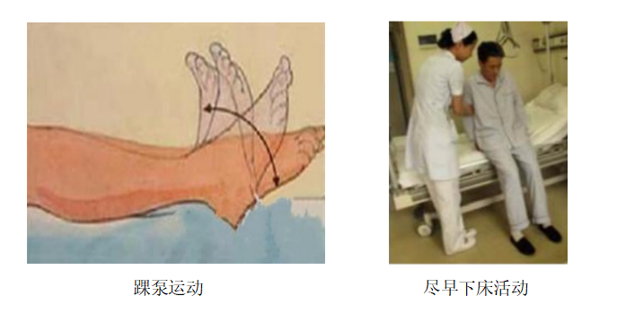 圍術(shù)期患者VTE的預(yù)防，只知道抗凝可不行