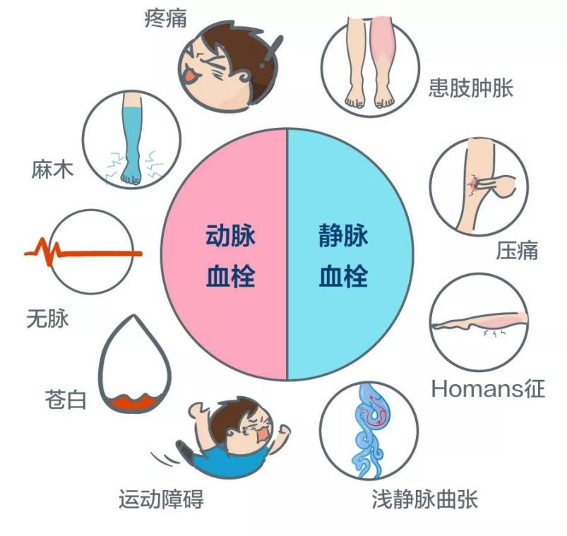 深靜脈血栓能致命，防治“大法”要了解！