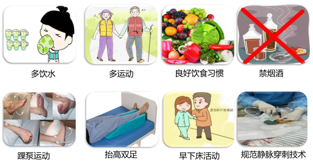 VTE的危害您了解嗎？